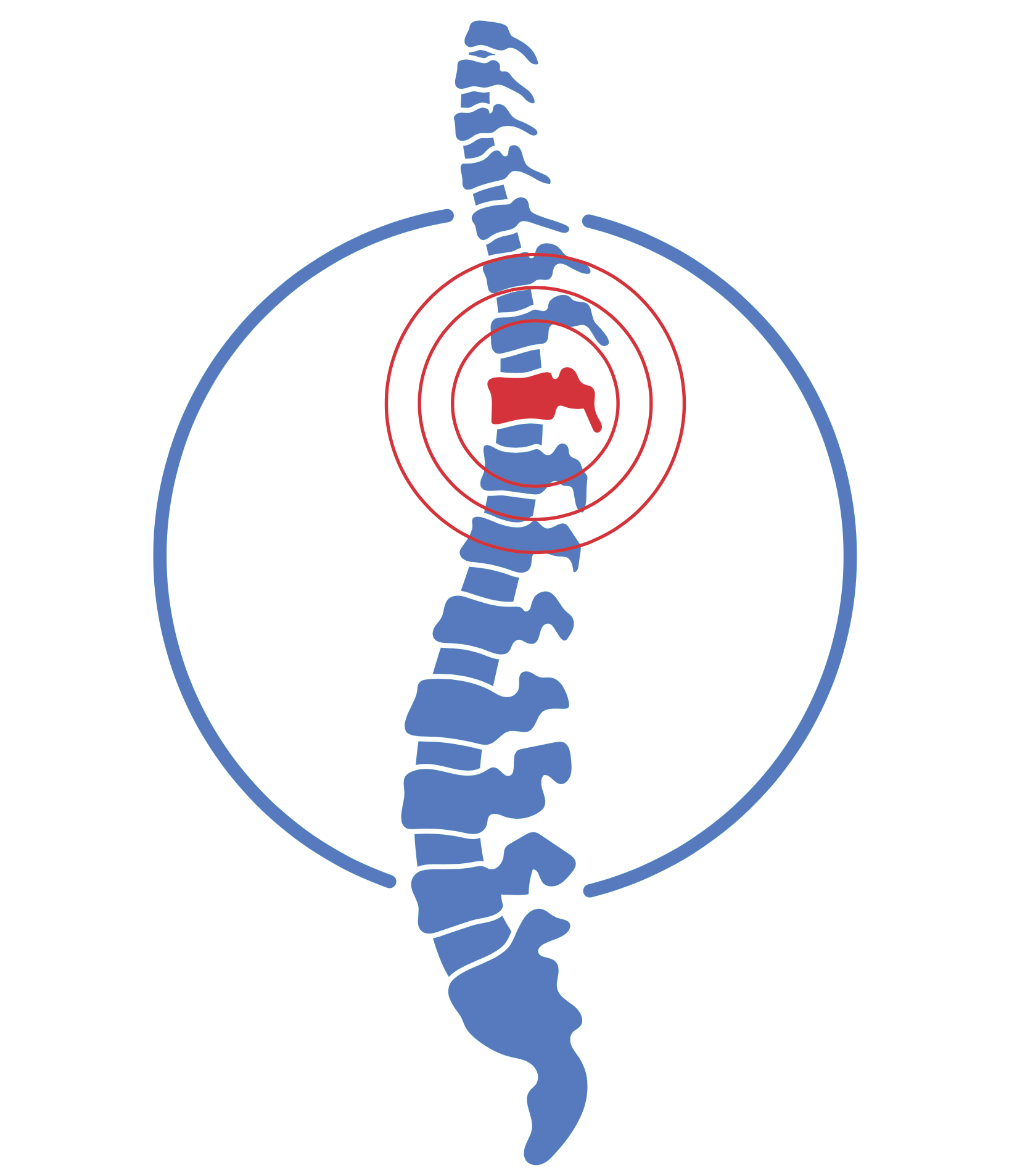 spine 1